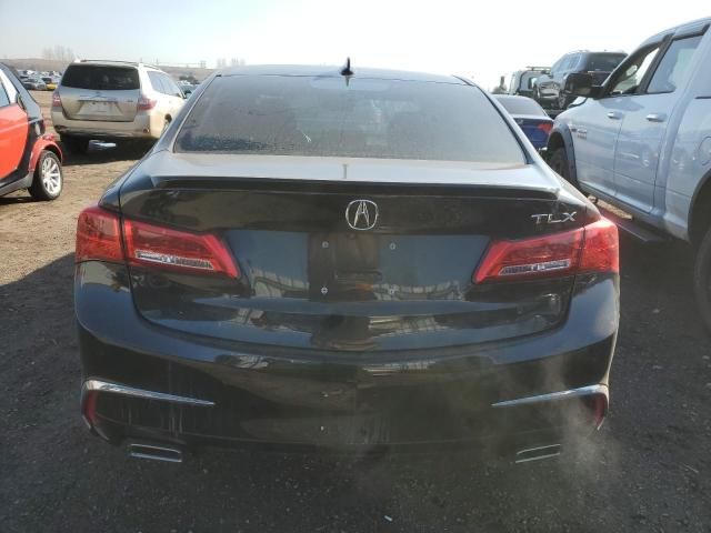 2018 Acura TLX Elite