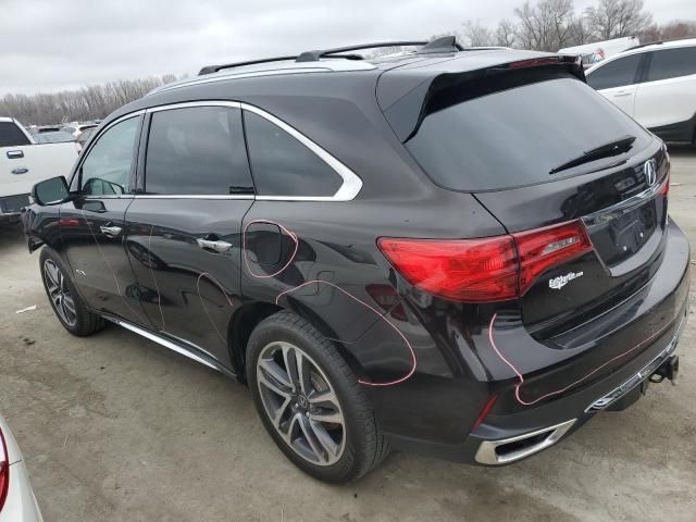 2017 Acura MDX Advance