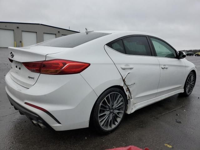 2017 Hyundai Elantra Sport