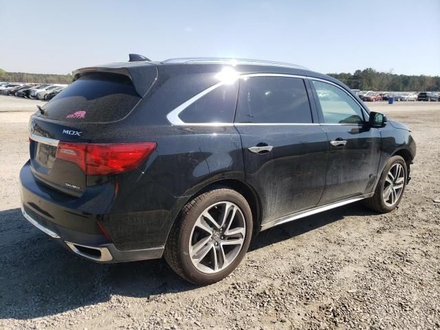 2017 Acura MDX Advance