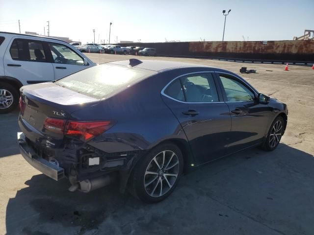 2015 Acura TLX Tech