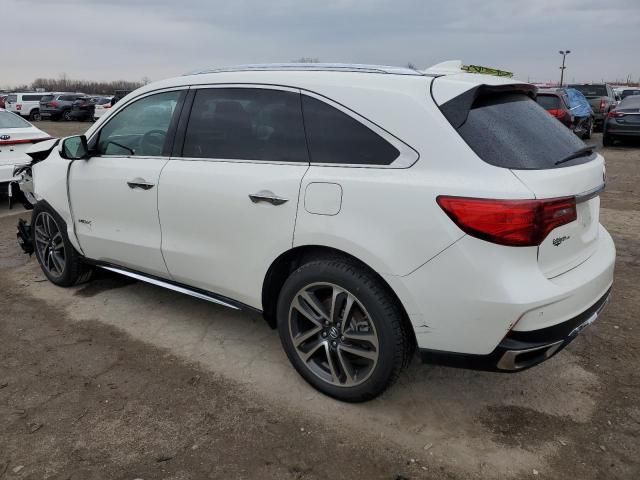 2017 Acura MDX Advance