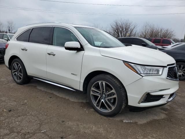 2017 Acura MDX Advance