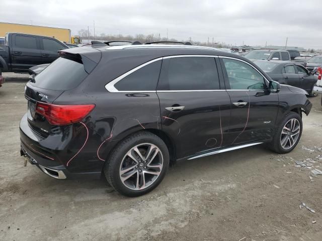 2017 Acura MDX Advance