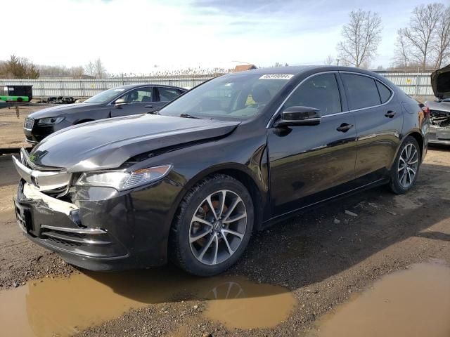 2015 Acura TLX Tech