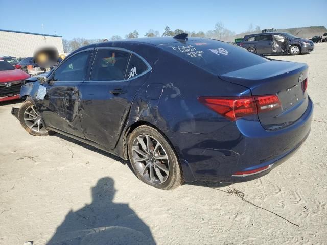 2015 Acura TLX Tech