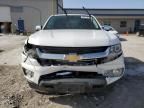 2015 Chevrolet Colorado LT