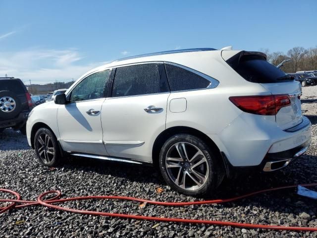 2017 Acura MDX Advance