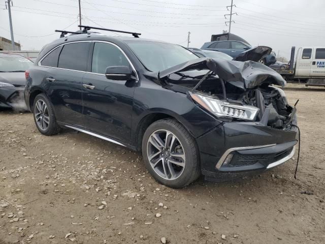 2017 Acura MDX Advance