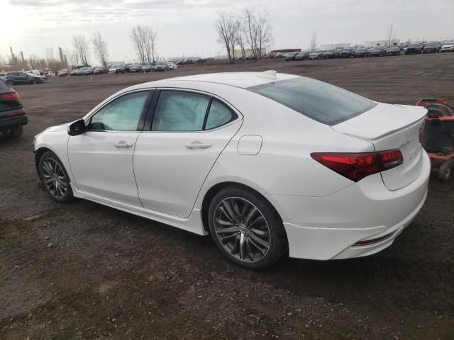 2017 Acura TLX Tech