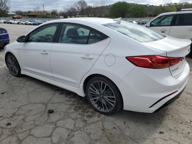 2017 Hyundai Elantra Sport