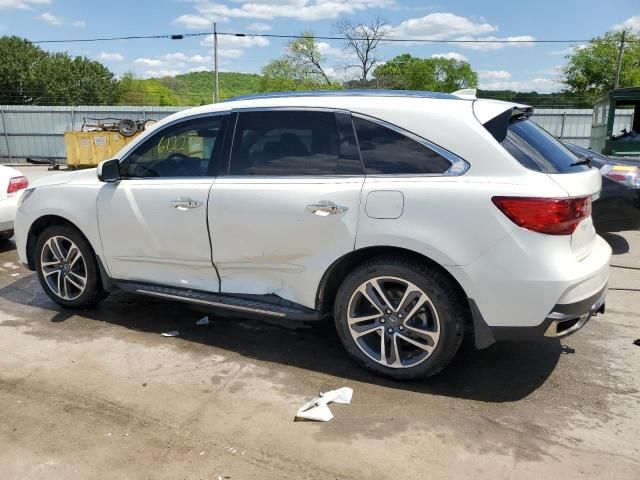 2017 Acura MDX Advance