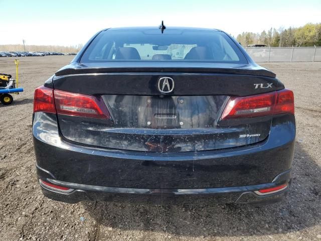 2017 Acura TLX Tech