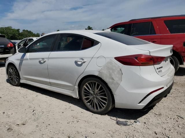 2017 Hyundai Elantra Sport