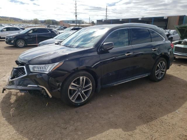 2017 Acura MDX Advance