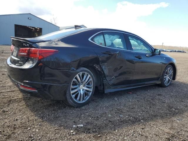 2017 Acura TLX Tech