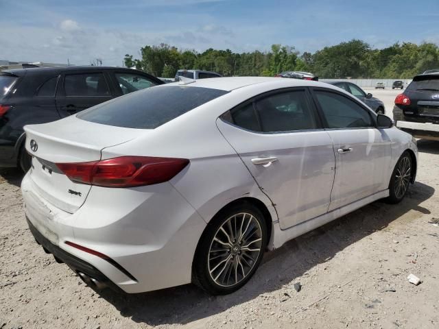 2017 Hyundai Elantra Sport