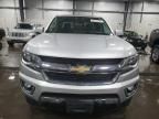 2017 Chevrolet Colorado LT