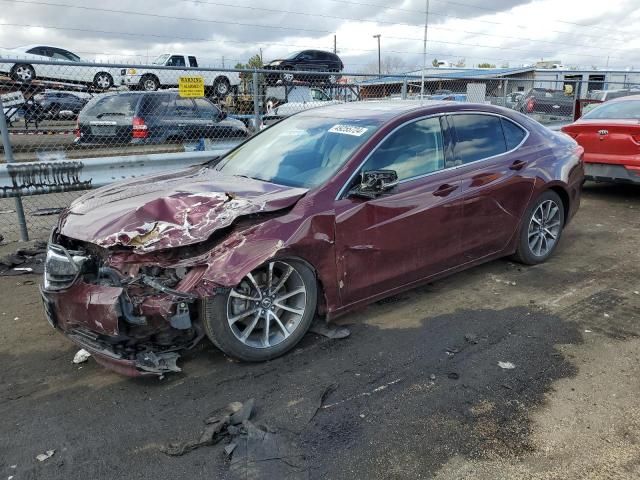 2015 Acura TLX Tech