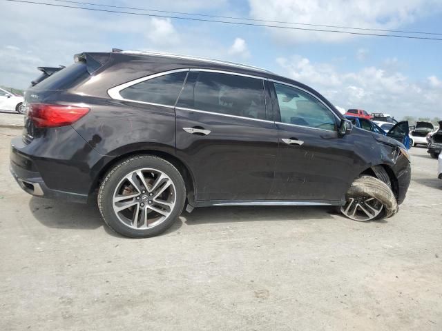 2017 Acura MDX Advance