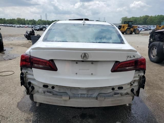 2015 Acura TLX Tech