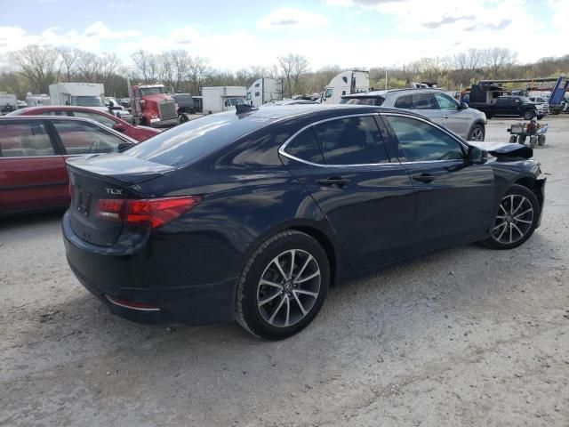 2017 Acura TLX Tech