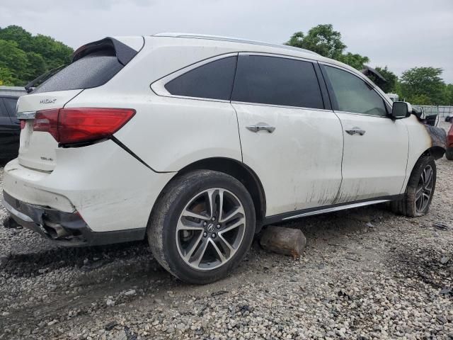 2017 Acura MDX Advance