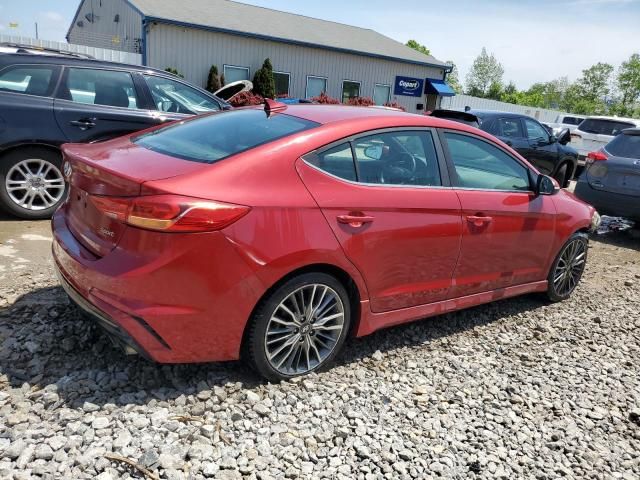 2017 Hyundai Elantra Sport