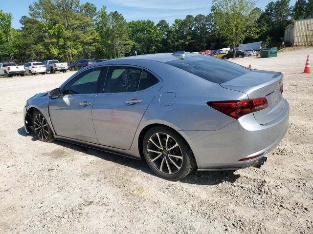 2015 Acura TLX Tech