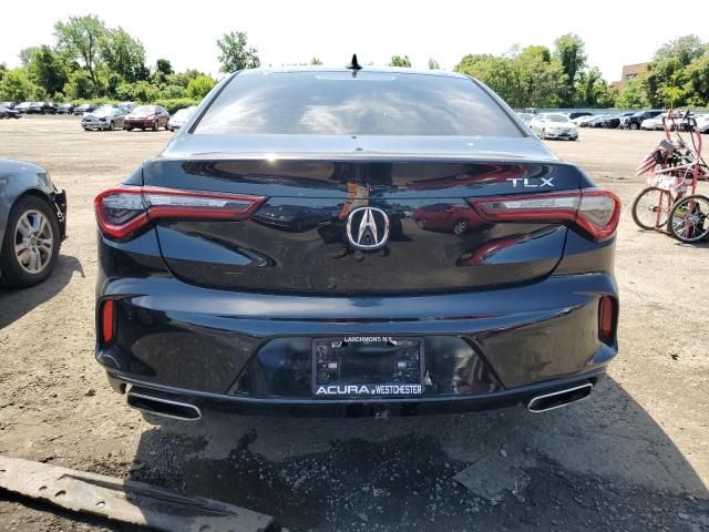 2021 Acura TLX Technology