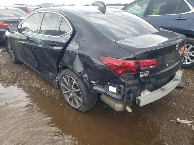 2015 Acura TLX Tech