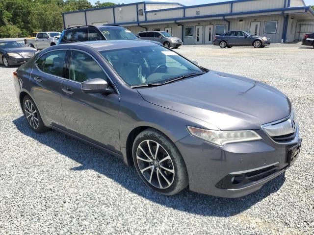 2017 Acura TLX Advance