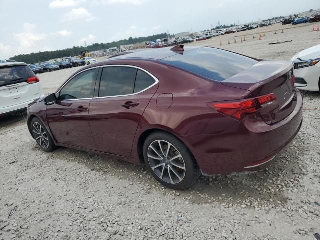 2015 Acura TLX Tech