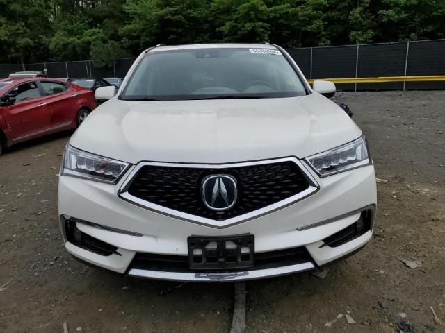 2017 Acura MDX Advance