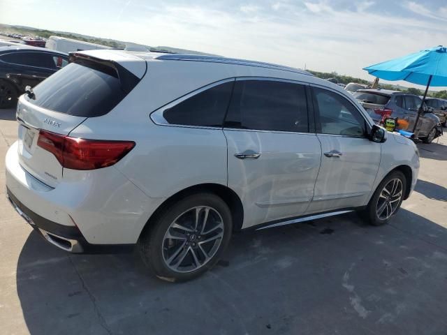 2017 Acura MDX Advance