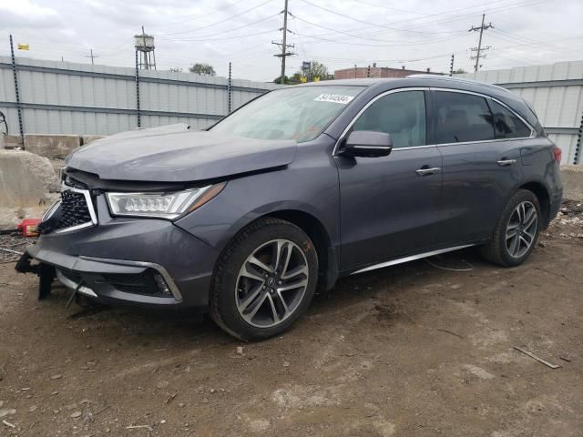 2017 Acura MDX Advance