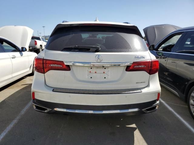 2017 Acura MDX Advance