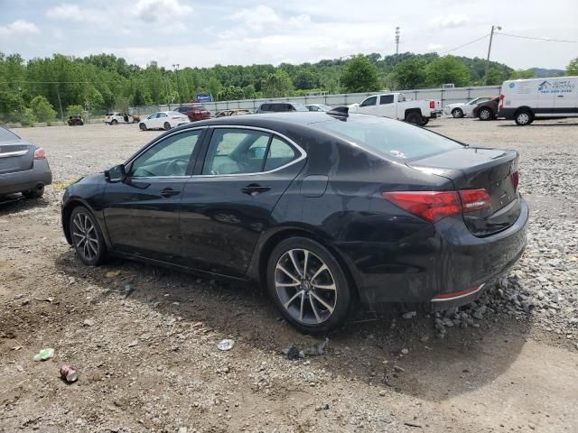 2017 Acura TLX Tech