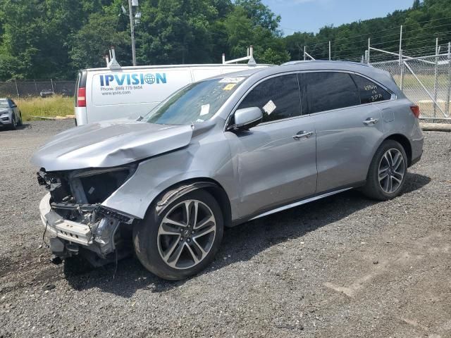 2017 Acura MDX Advance