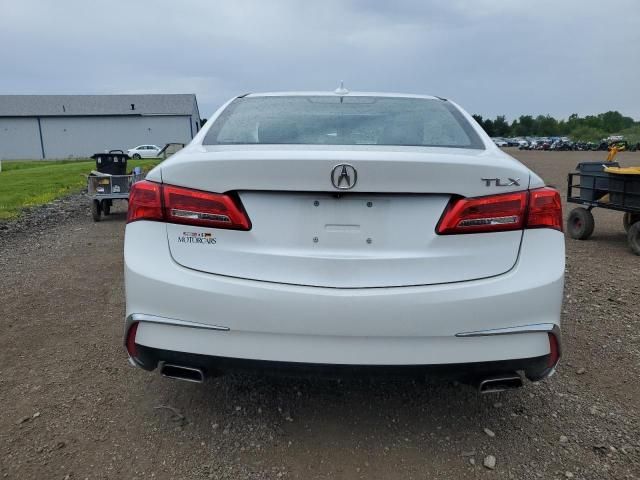 2019 Acura TLX Technology