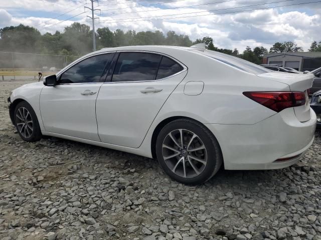 2015 Acura TLX Tech