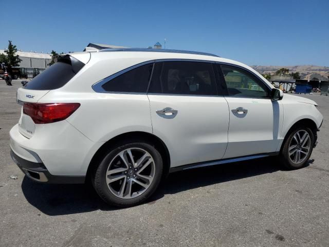 2017 Acura MDX Advance