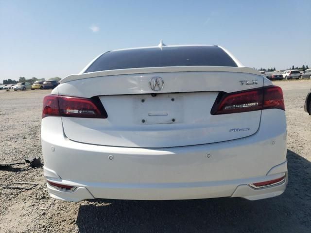 2015 Acura TLX Advance