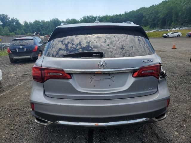 2017 Acura MDX Advance