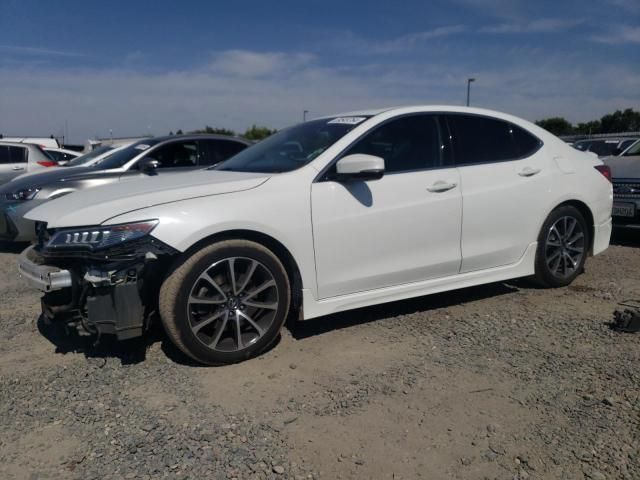 2015 Acura TLX Advance