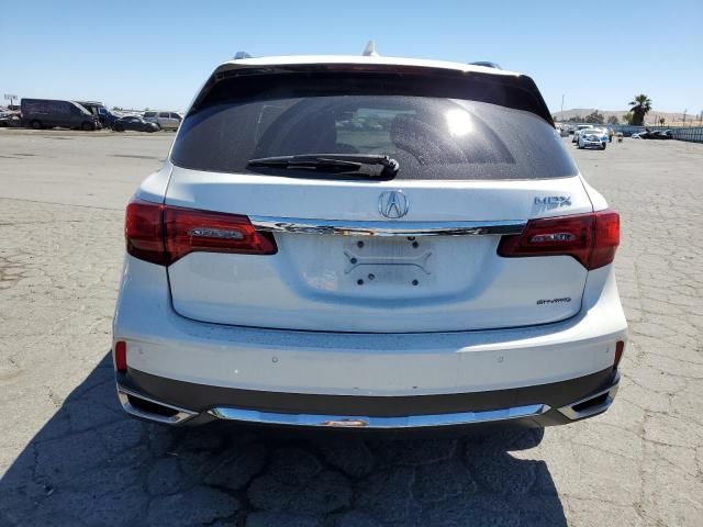 2017 Acura MDX Advance