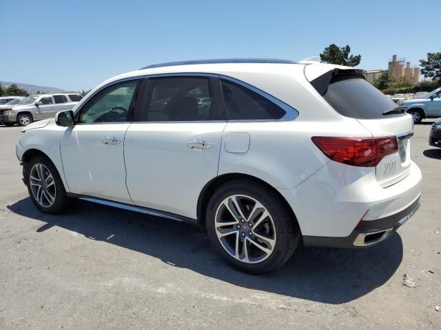 2017 Acura MDX Advance