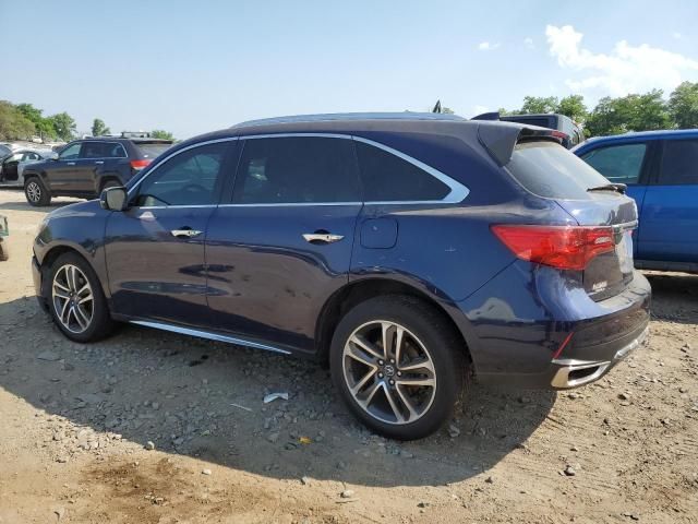 2017 Acura MDX Advance