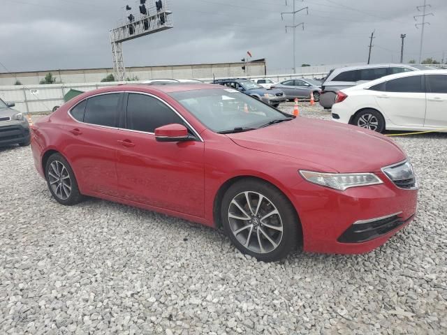 2017 Acura TLX Tech