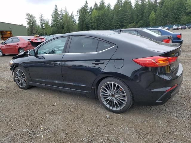 2018 Hyundai Elantra Sport